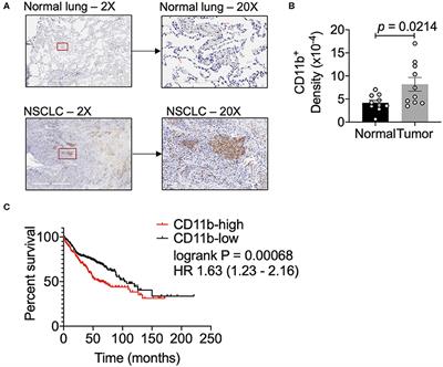 Positive Allosteric Modulation of CD11b as a Novel Therapeutic Strategy Against Lung Cancer